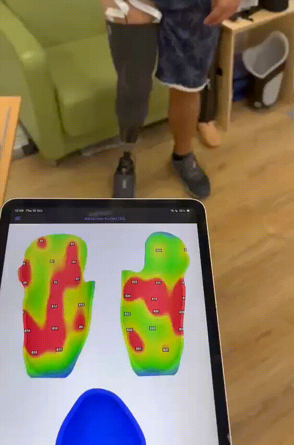 SocketSense Technology