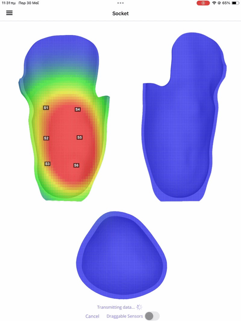 ProstheticSense mobile app interface